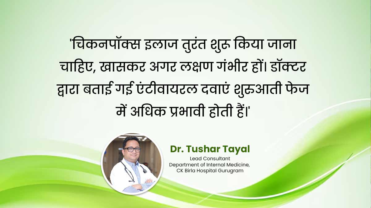 Chickenpox treatment