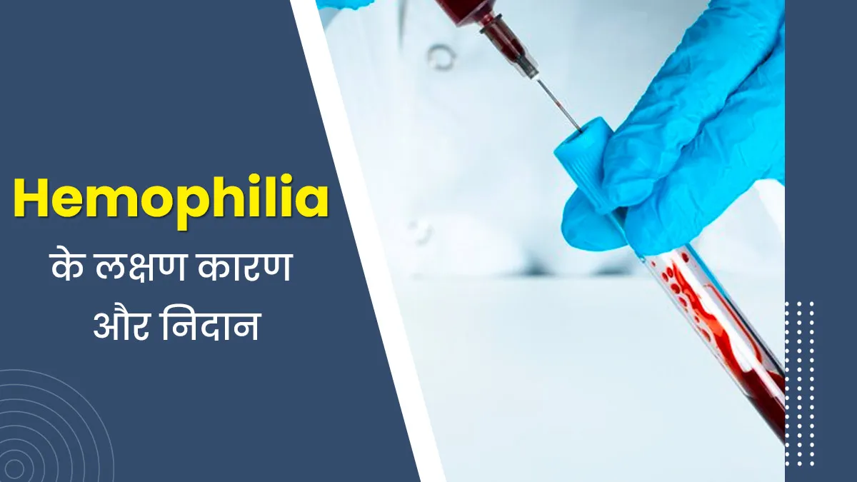 जेनेटिक ब्लड डिसऑर्डर है Hemophilia, जानें इसके लक्षण कारण और निदान