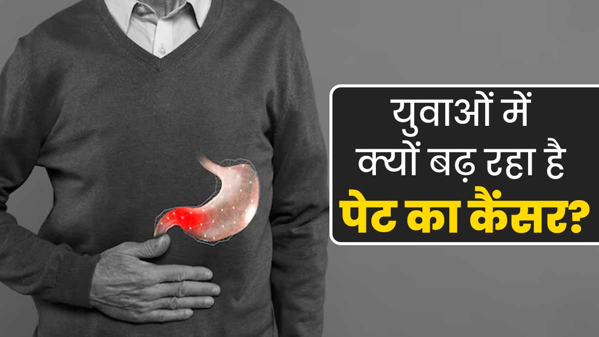 युवाओं में क्यों बढ़ रहे हैं पेट के कैंसर के मामले, डॉक्टर से जानें