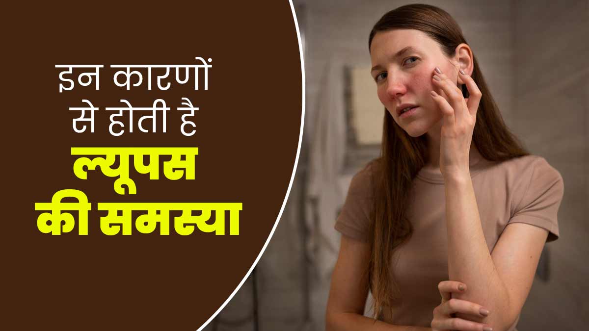 इन कारणों से होती है ल्यूपस की समस्या, जानें इस बीमारी की वजहें