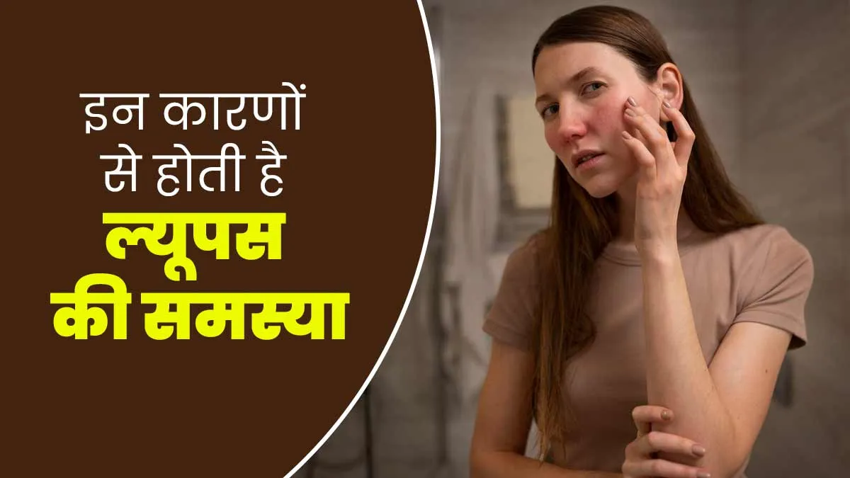 इन कारणों से होती है ल्यूपस की समस्या, जानें इस बीमारी की वजहें