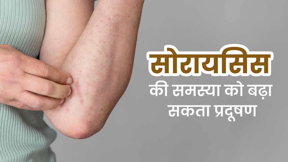 प्रदूषण से बढ़ सकती है सोरायसिस की समस्या, डॉक्टर से जानें बचाव के उपाय