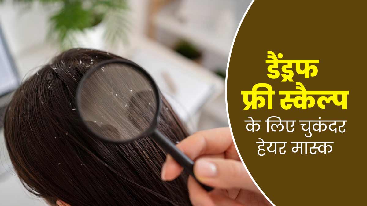 सर्दियों में डैंड्रफ का आसान इलाज है चुकंदर हेयर मास्क, स्कैल्प भी होगा हेल्दी