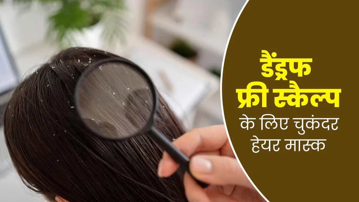सर्दियों में डैंड्रफ का आसान इलाज है चुकंदर हेयर मास्क, स्कैल्प भी होगा हेल्दी