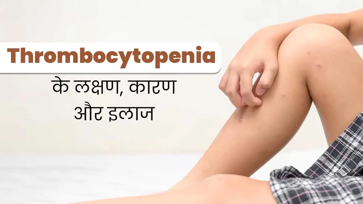 खून में प्लेटलेट्स कम होना है थ्रोम्बोसाइटोपेनिया, जानें इसके लक्षण, कारण और इलाज