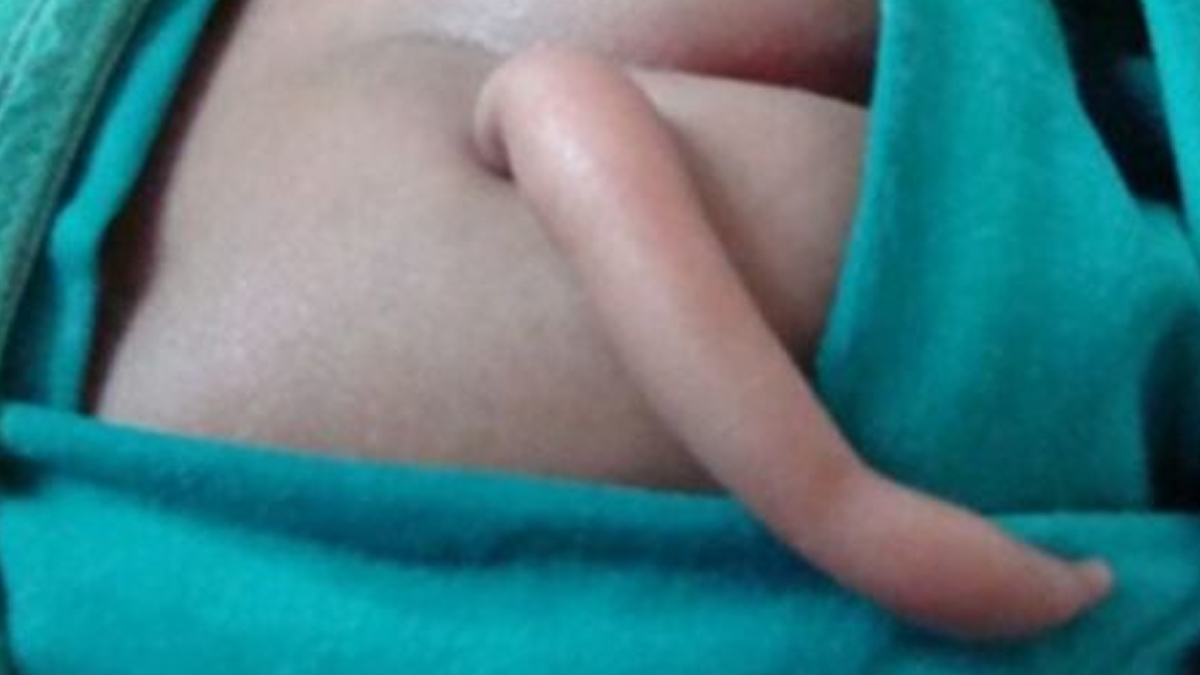 Cognitive-Tail-inside