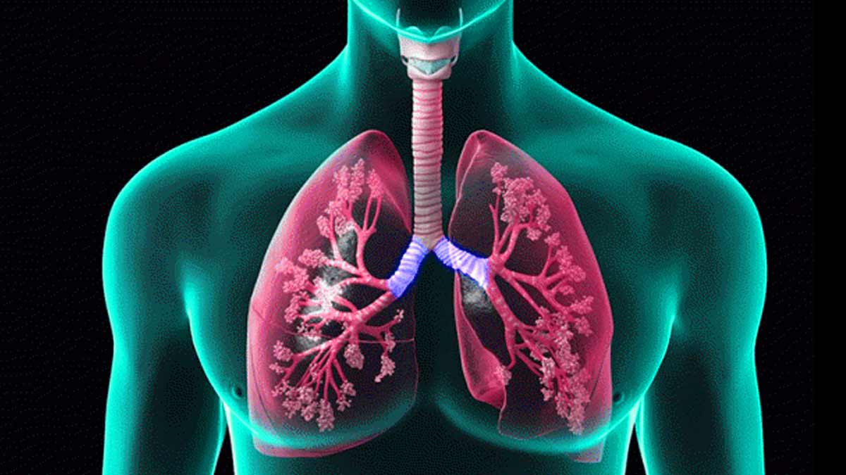 lungs health lumps-in-lungs-inside4