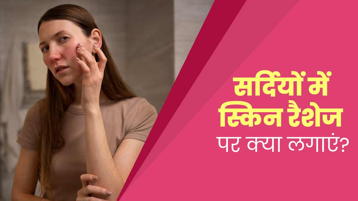 सर्दियों में चेहरे पर रैशेज होने पर आजमाएं ये 5 घरेलू उपाय