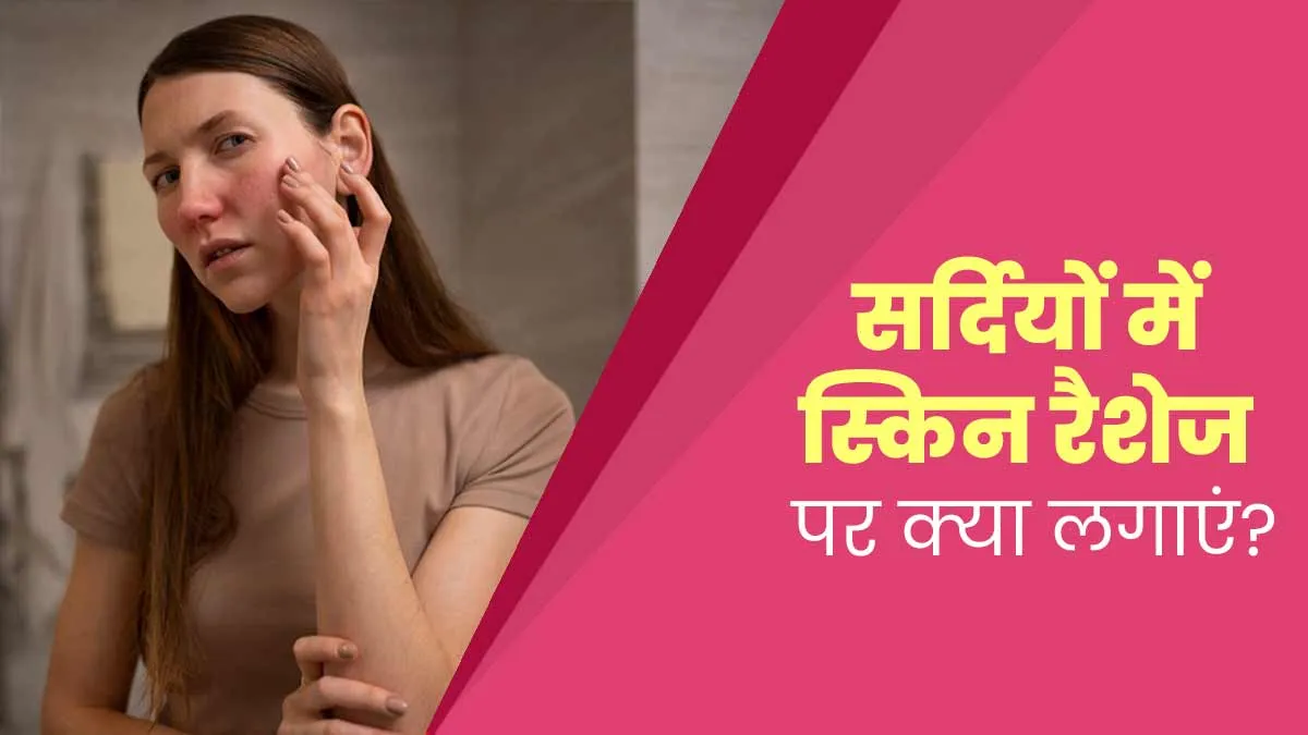 सर्दियों में चेहरे पर रैशेज होने पर आजमाएं ये 5 घरेलू उपाय