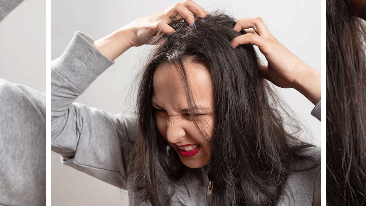 how-to-treat-dry-scalp-ayurvedic-remedies-in