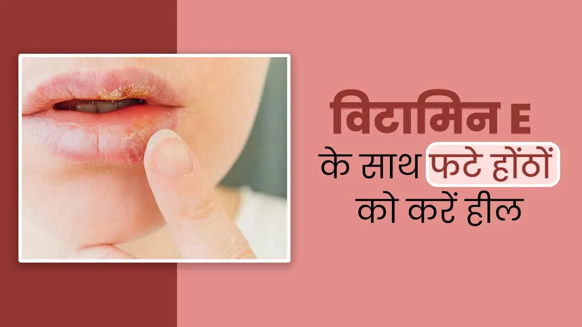 सर्दियों में फटे होंठों को सॉफ्ट बनाएगा विटामिन E कैप्सूल, जानें प्रयोग का तरीका