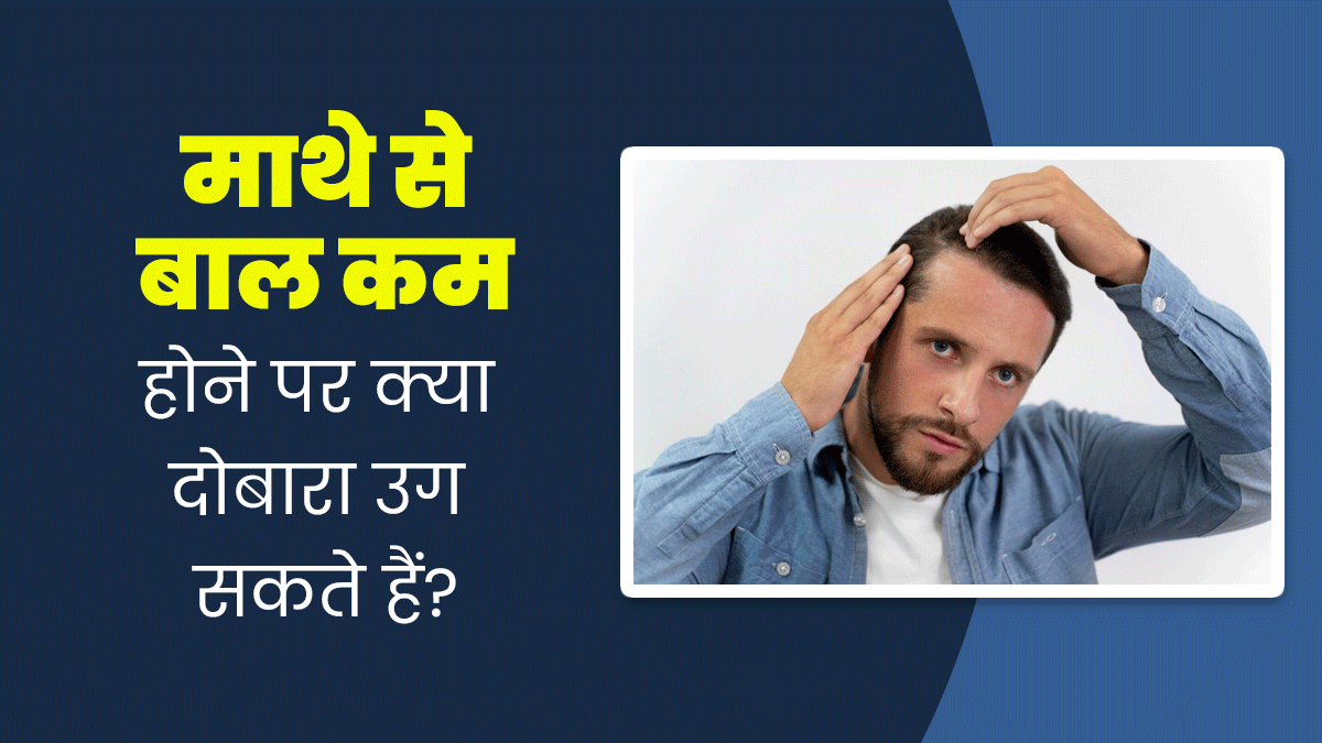क्या झड़ने के बाद दोबारा उग सकते हैं हेयरलाइन के बाल? डॉक्टर से जानें