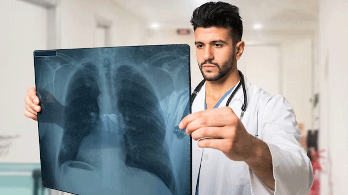 क्या फेफड़ों की बीमारी वाले लोगों में Lung Cancer होने का जोखिम अधिक रहता है? एक्सपर्ट से जानें