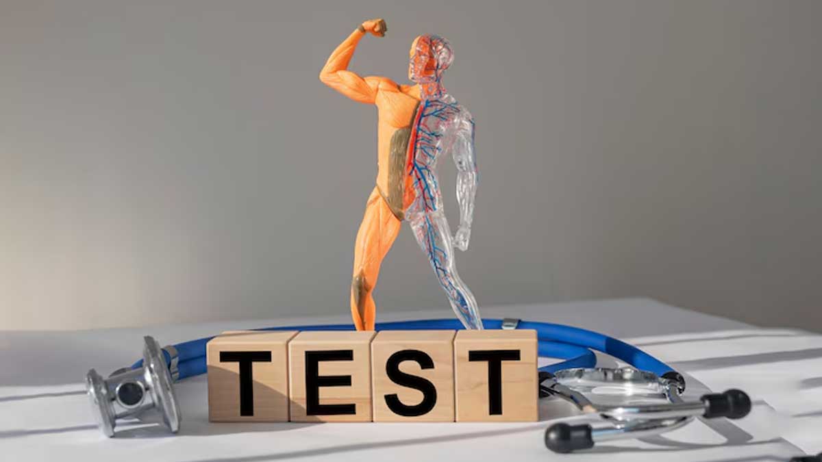 What is a testosterone level test 02