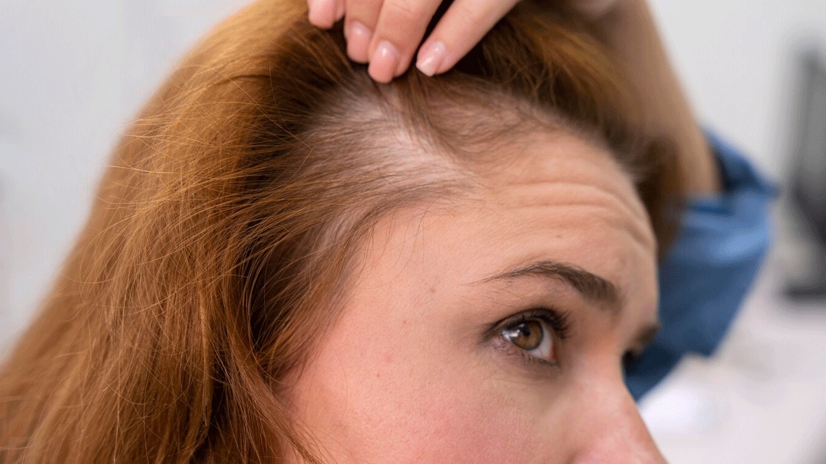 mportant-nutrients-for-hair-growth-in-hindi can-hair-grow-back-after-receding-hairline-in