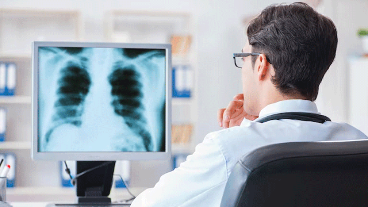 Lung cancer lung-cancer-inside