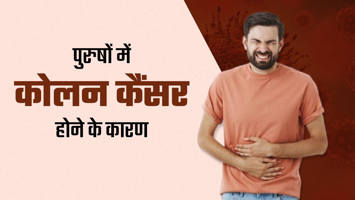 महिलाओं के मुकाबले पुरुषों में क्यों है कोलन कैंसर होने का जोखिम ज्यादा? डॉक्टर से जानें बचाव के उपाय