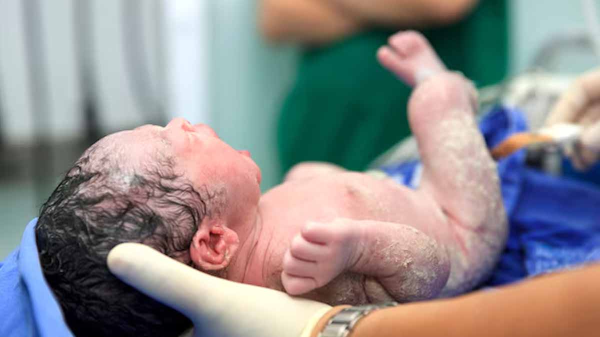 complications-during-neonatal-periods-m