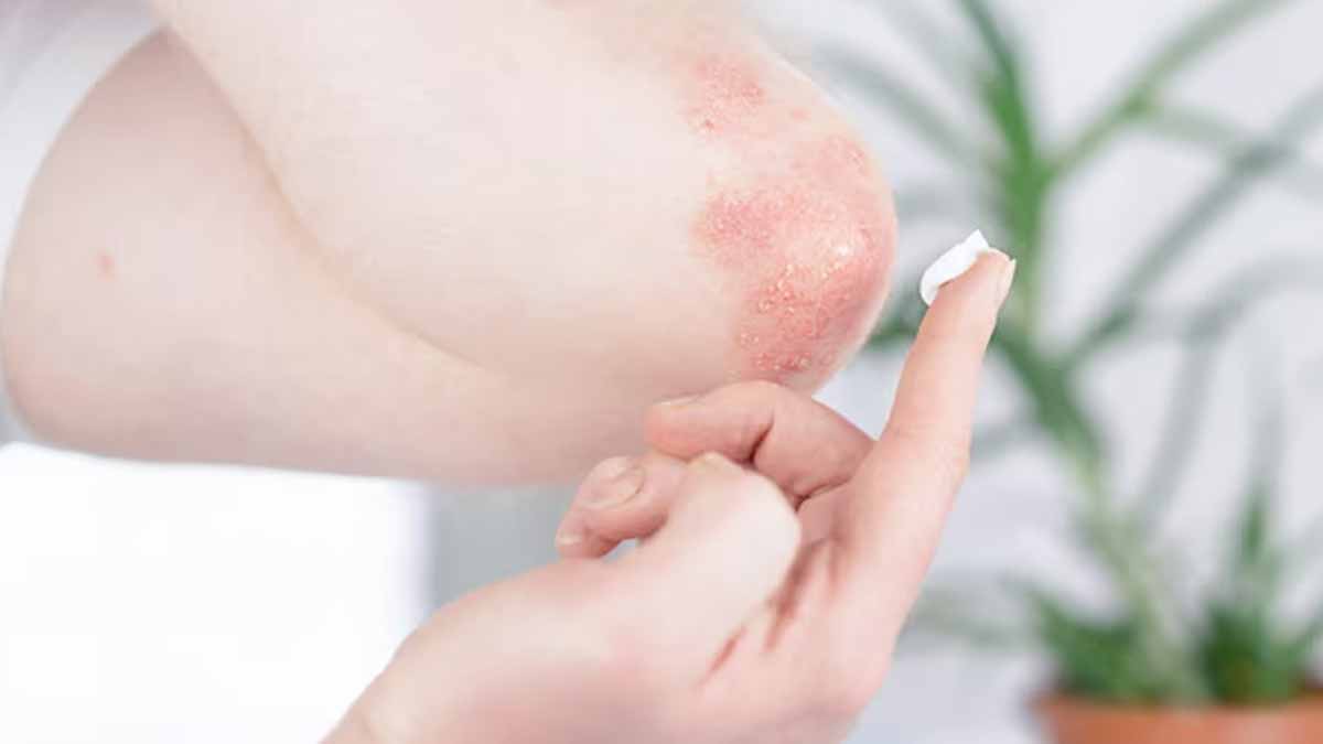 risk-factor-of-fungal-infection-in-cancer-in
