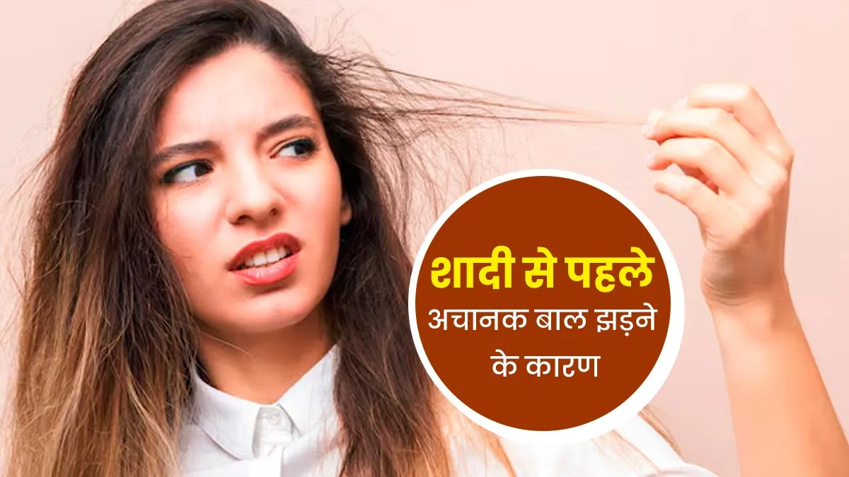 शादी से पहले अचानक बढ़ गई बाल झड़ने की समस्या तो एक्सपर्ट से जानें इसके कारण