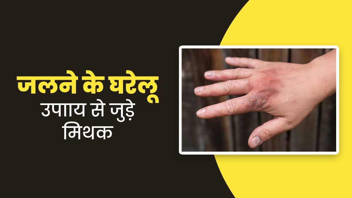 जली हुई त्वचा पर टूथपेस्ट लगाना सही है या नहीं? जानें जलने के घरेलू उपायों से जुड़े 5 मिथकों की सच्चाई