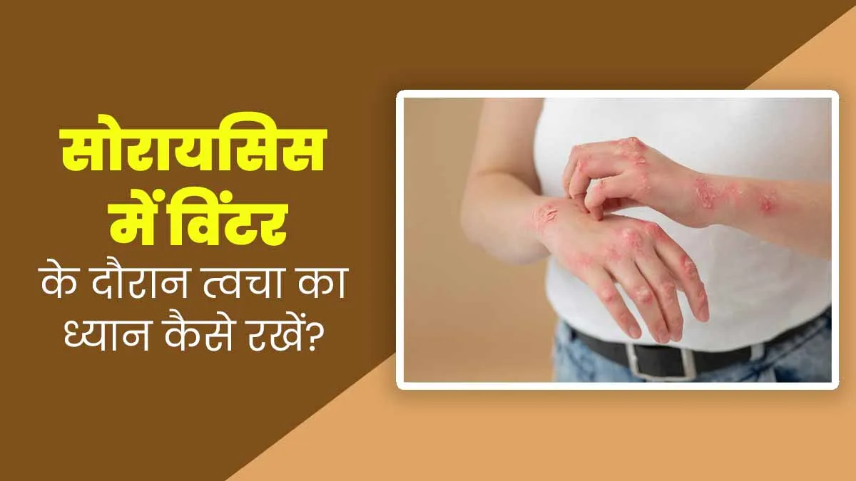 सोरायसिस की समस्या में सर्दियों के दौरान त्वचा का ख्याल कैसे रखें? जानें डॉक्टर से
