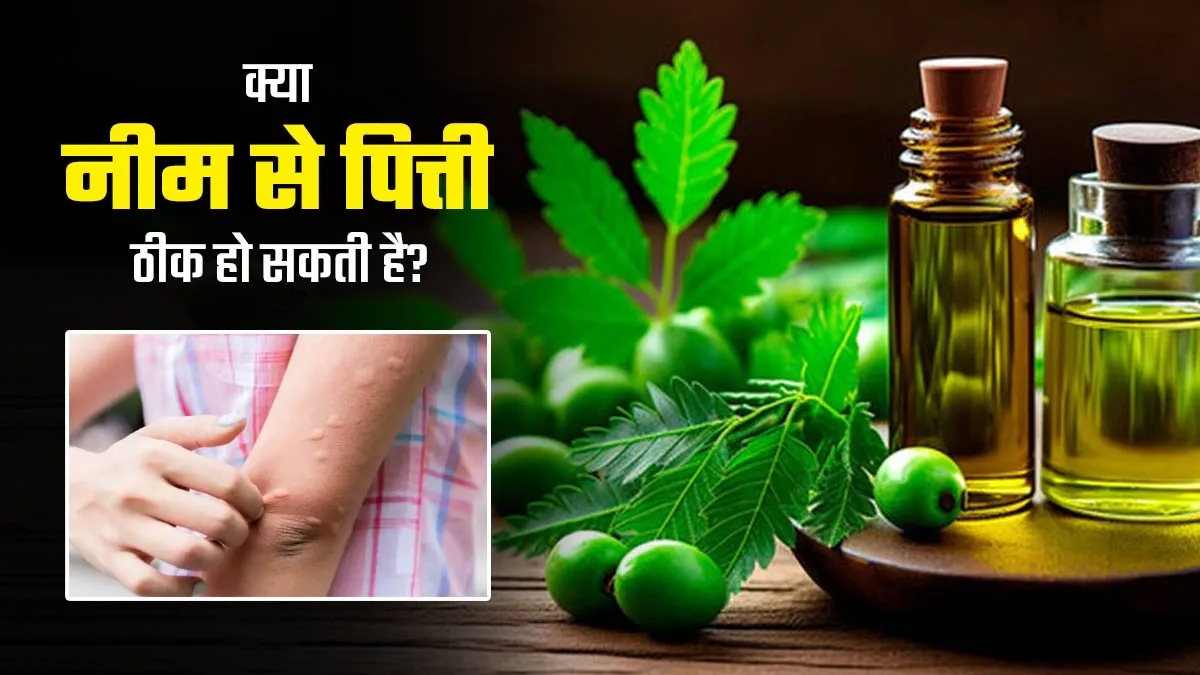 क्या नीम से पित्ती ठीक हो सकती है? डॉक्टर से जानें खुजली और जलन से कैसे दिलाता है राहत