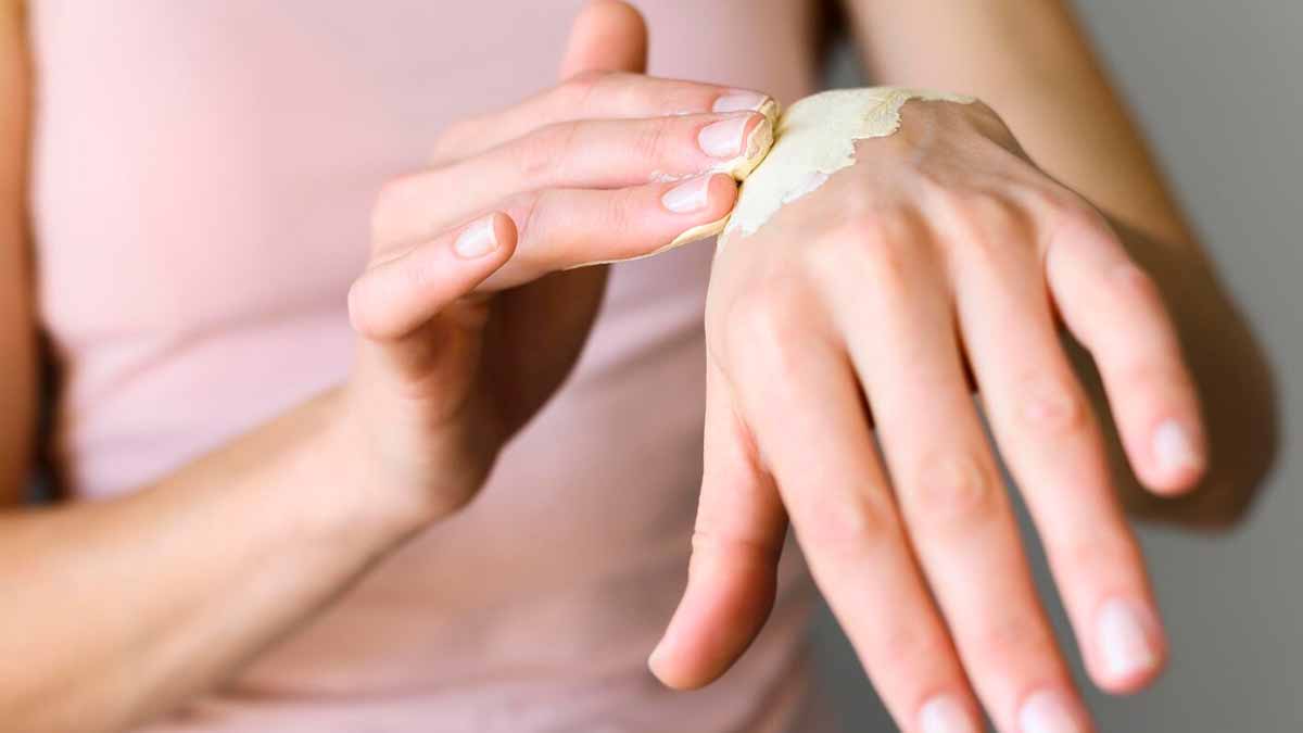 burns-for-home-remedies