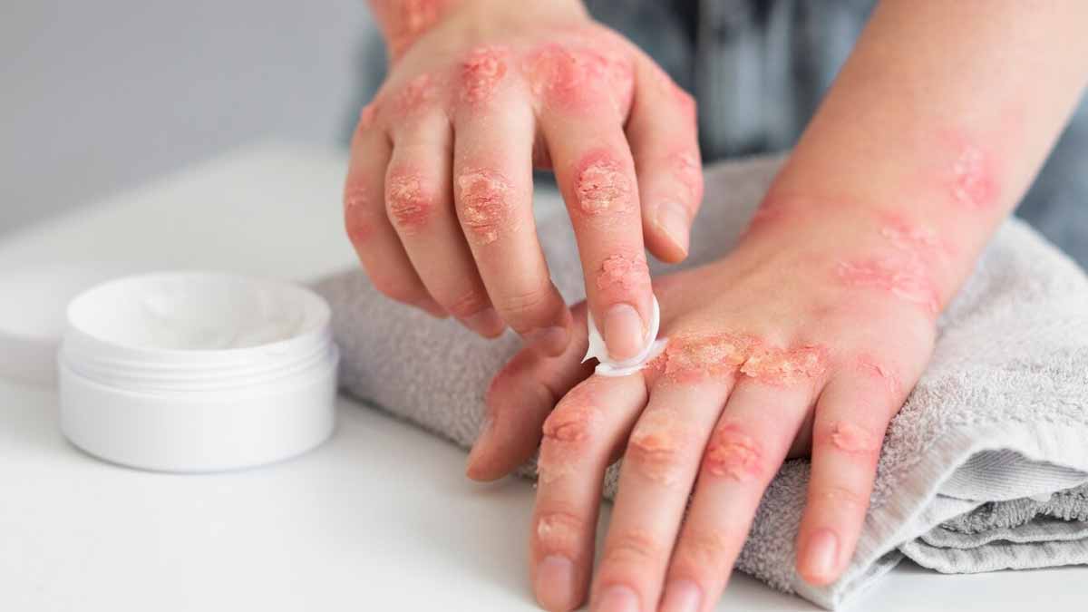inside-winter-skin-problem