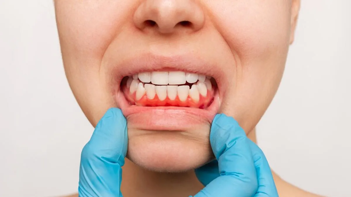 Gums Care: बुजुर्ग मसूड़ों को कैसे बनाएं मजबूत? जानें एक्सपर्ट से