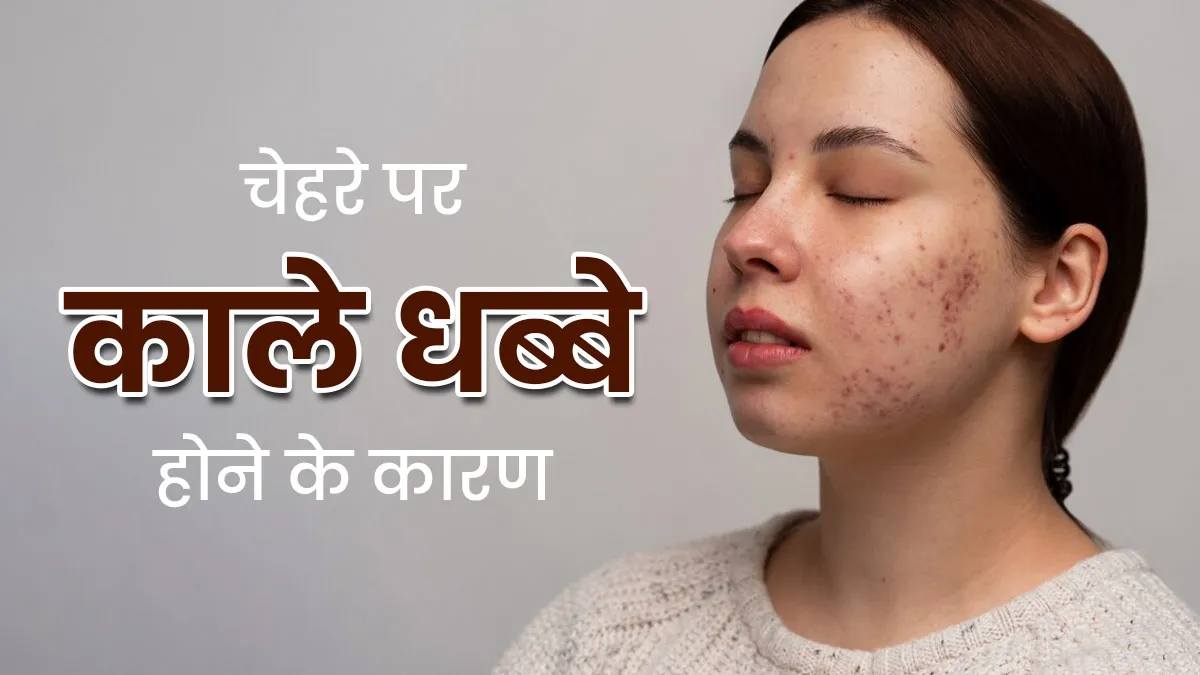 चेहरे पर काले धब्बे क्यों हो जाते हैं? एक्सपर्ट से जानें 5 कारण