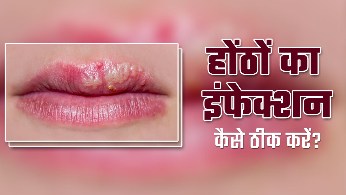 होंठों में इंफेक्शन होने पर आजमाएं ये 4 टिप्स, जलन और खुजली की समस्या से भी मिलेगी राहत