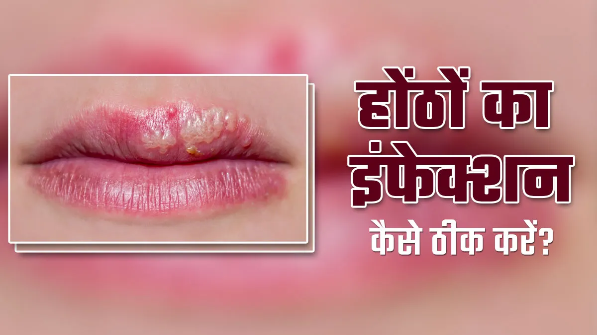 होंठों में इंफेक्शन होने पर आजमाएं ये 4 टिप्स, जलन और खुजली की समस्या से भी मिलेगी राहत