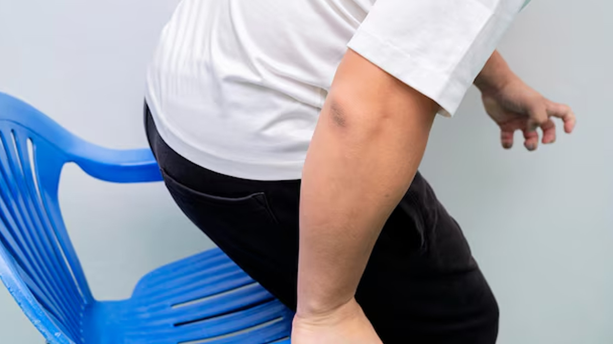 Ayurvedic Treatment Of Rectal Pimple In Hindi ayurvedic-treatment-of-pimple-in-rectal-i