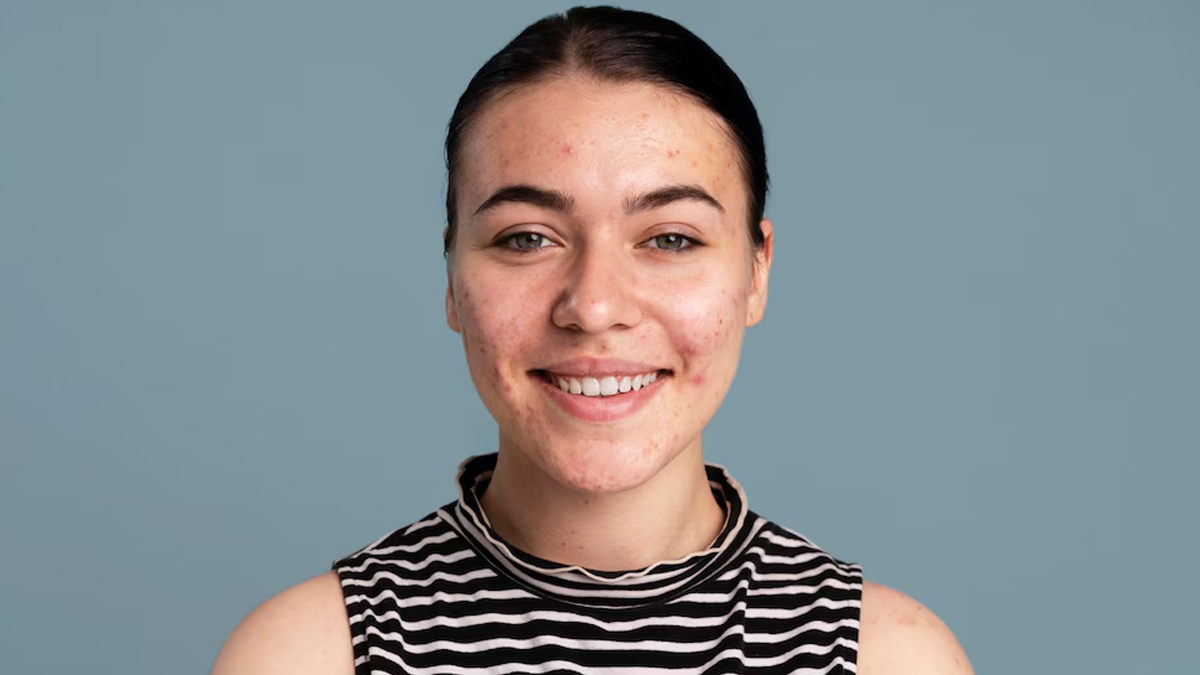 black spots black-sports-inside