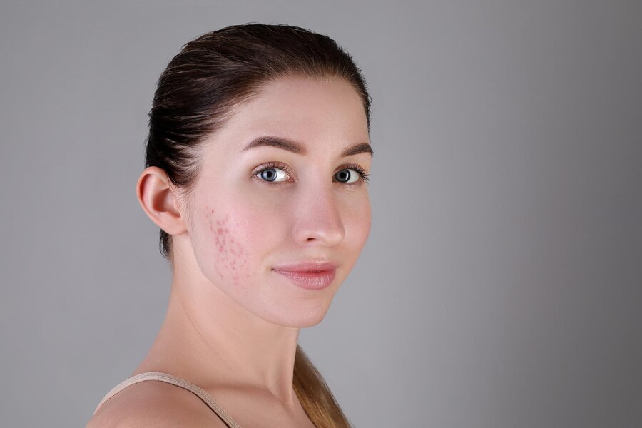surgical and non-surgical Options to manage facial scars 1