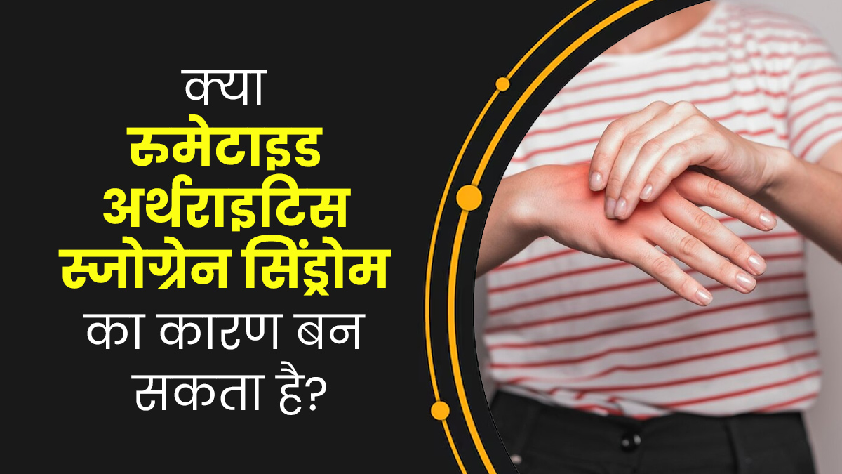 क्या रूमेटाइड अर्थराइटिस स्जोग्रेन सिंड्रोम (ऑटोइम्यून विकार) का कारण बन सकता है? डॉक्टर से जानें