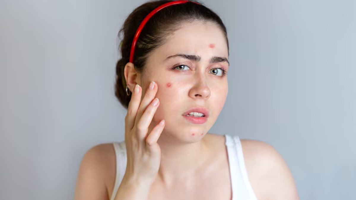 Skin Treatments For Different Problems