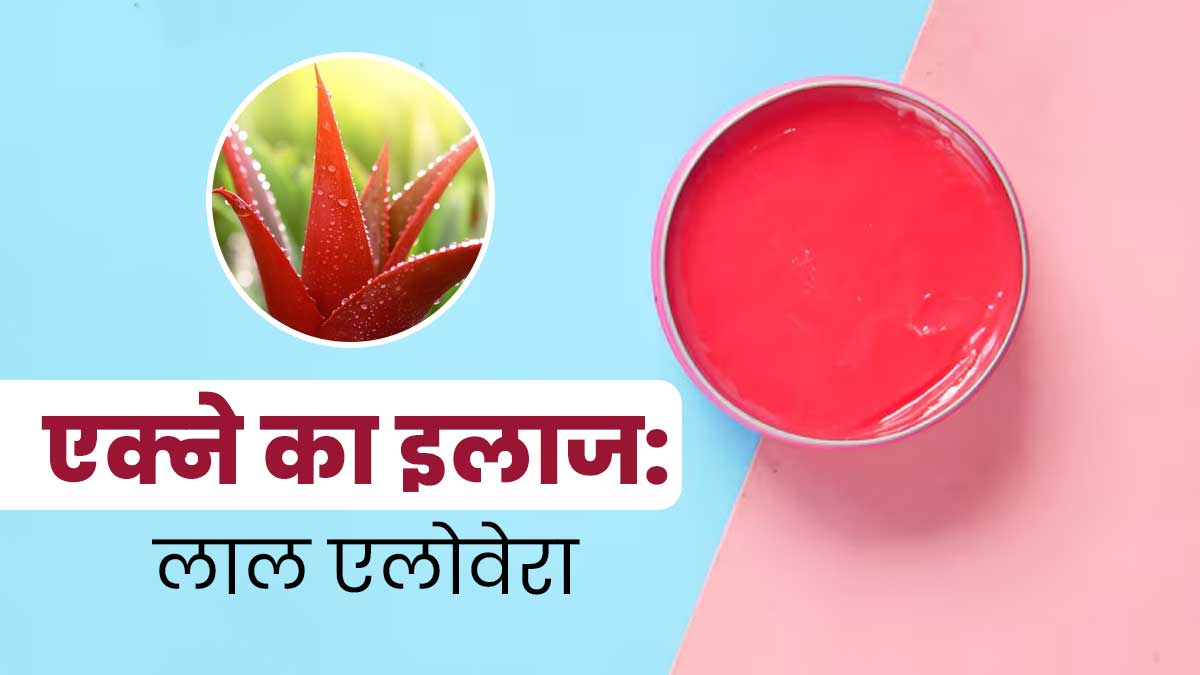 एक्‍ने से राहत पाने में मदद करता है लाल एलोवेरा, जानें इस्‍तेमाल के 5 तरीके