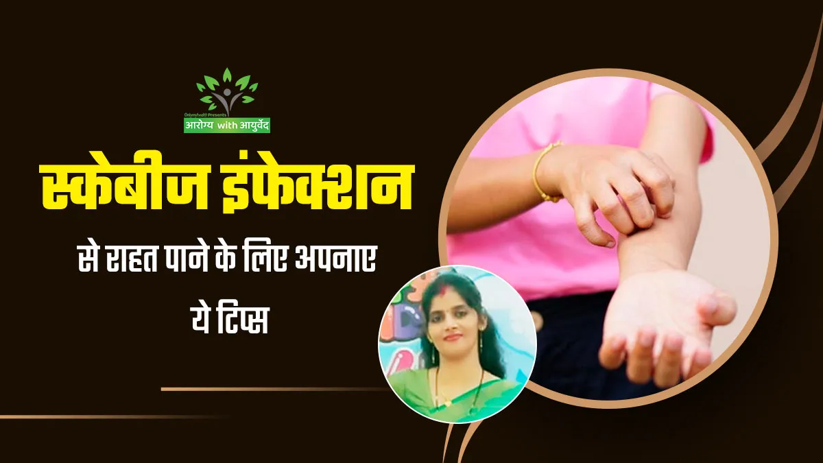 प्रेग्नेंसी में स्कैबीज इंफेक्शन से परेशान हो गई थीं श्वेता त्रिपाठी, राहत पाने के लिए अपनाएं ये 5 टिप्स