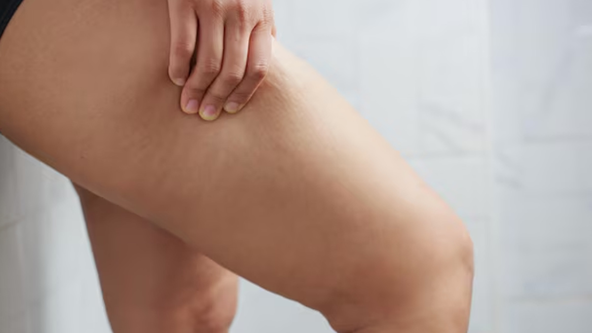How-to-tighten-saggy-skin-due-to-weight-loss-in