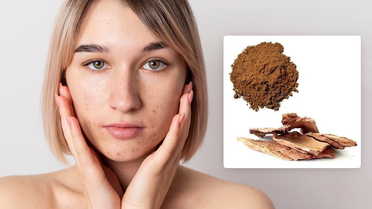 How To Use Arjuna Bark In Pigmentation In Hindi benefits-of-arjuna-bark-for-pigmentation-in