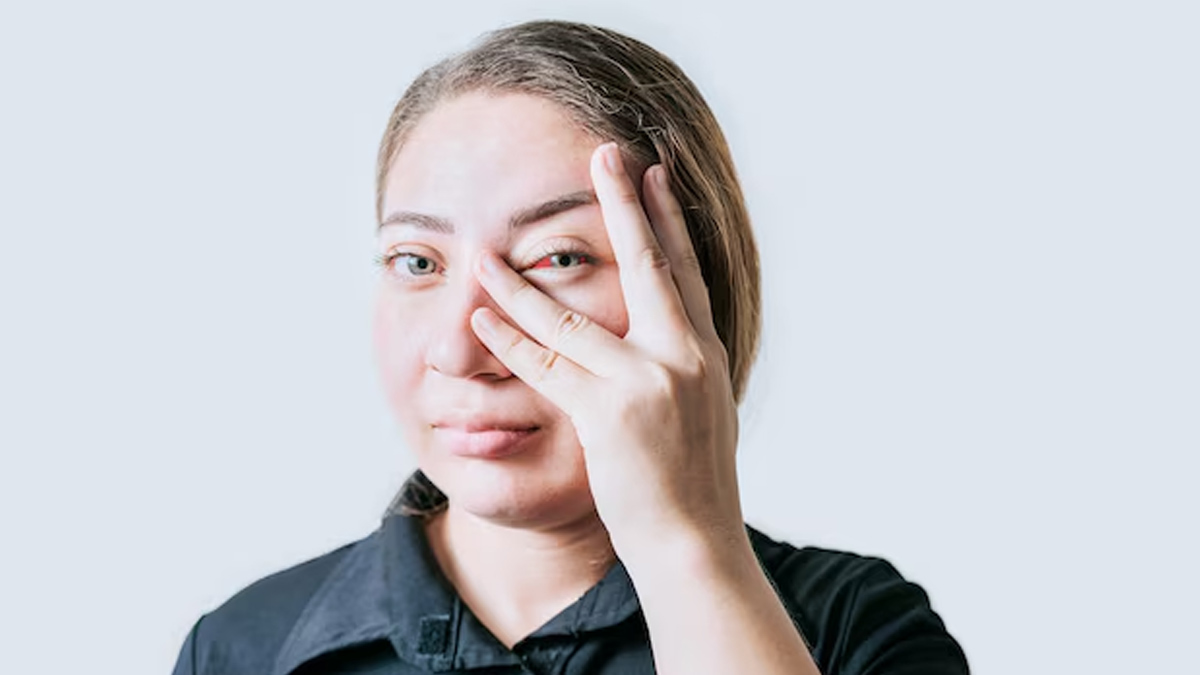 stroke causes eye problems expert advice