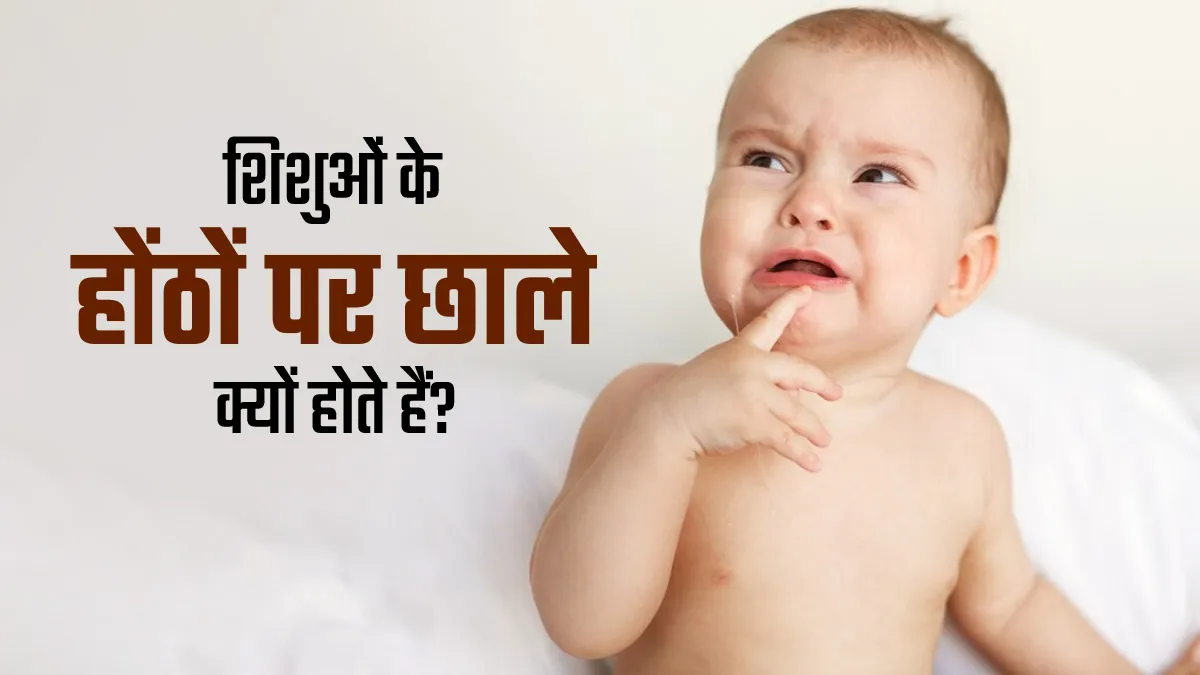 Lip Blisters: शिशुओं के होंठों पर छाले क्यों होते हैं? जानें इसके कारण
