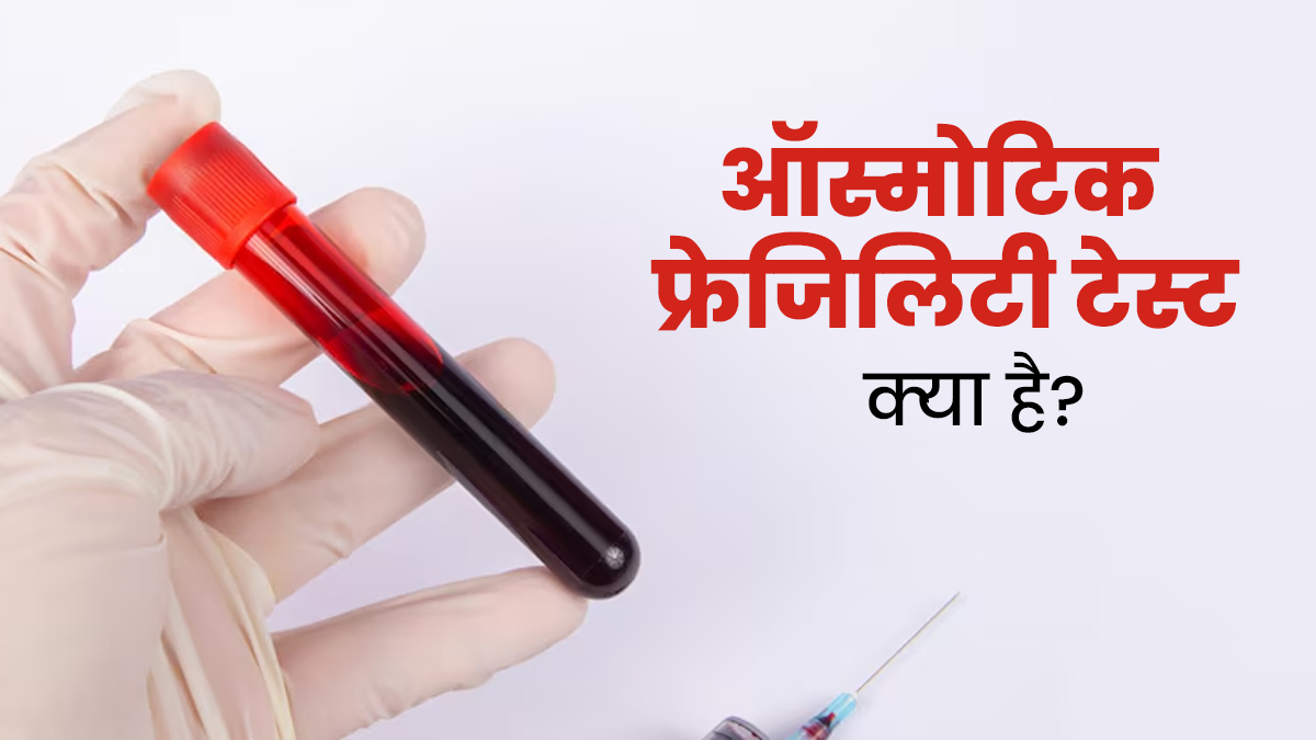 खून की बीमारियों की जांच करता है ऑस्मोटिक फ्रेजिलिटी टेस्ट, जानें कब और क्‍यों पड़ती है इसकी जरूरत