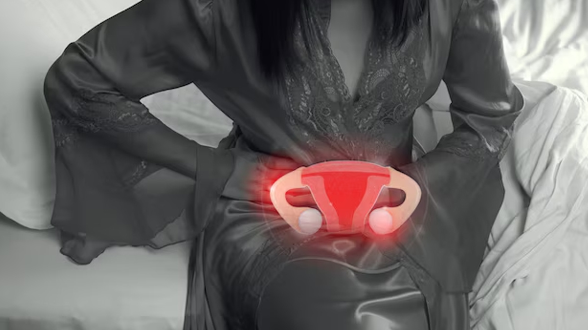 how-does-endometriosis-affect-ovulation-i