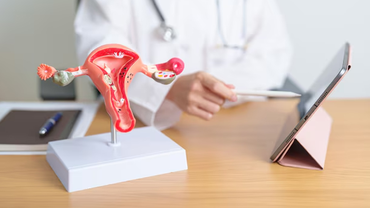 Common-Symptoms-of-Endometriosis-inside