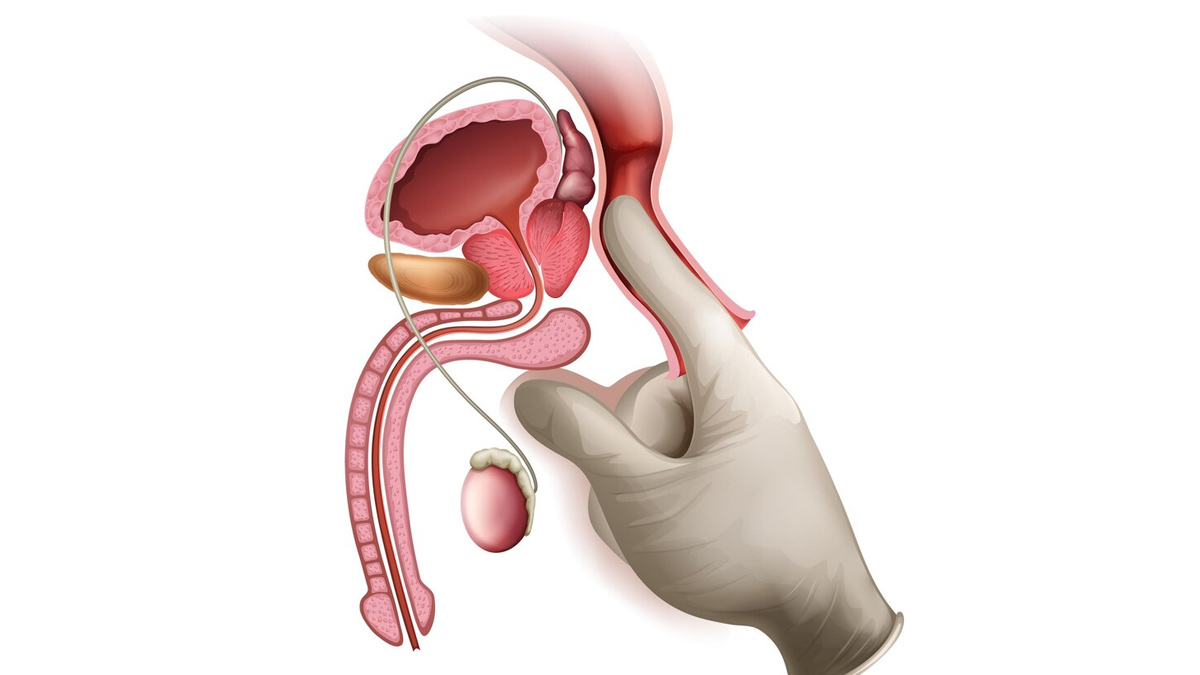 can prostate infection cause infertility 01