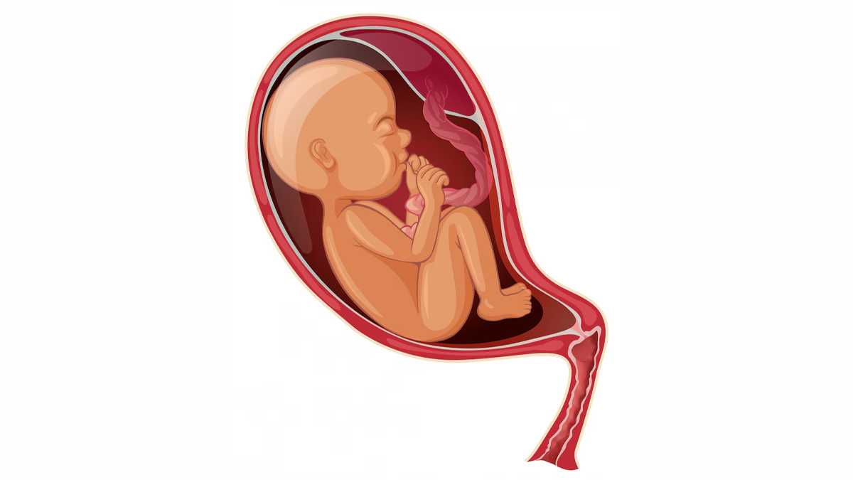 does placenta previa affect baby 01