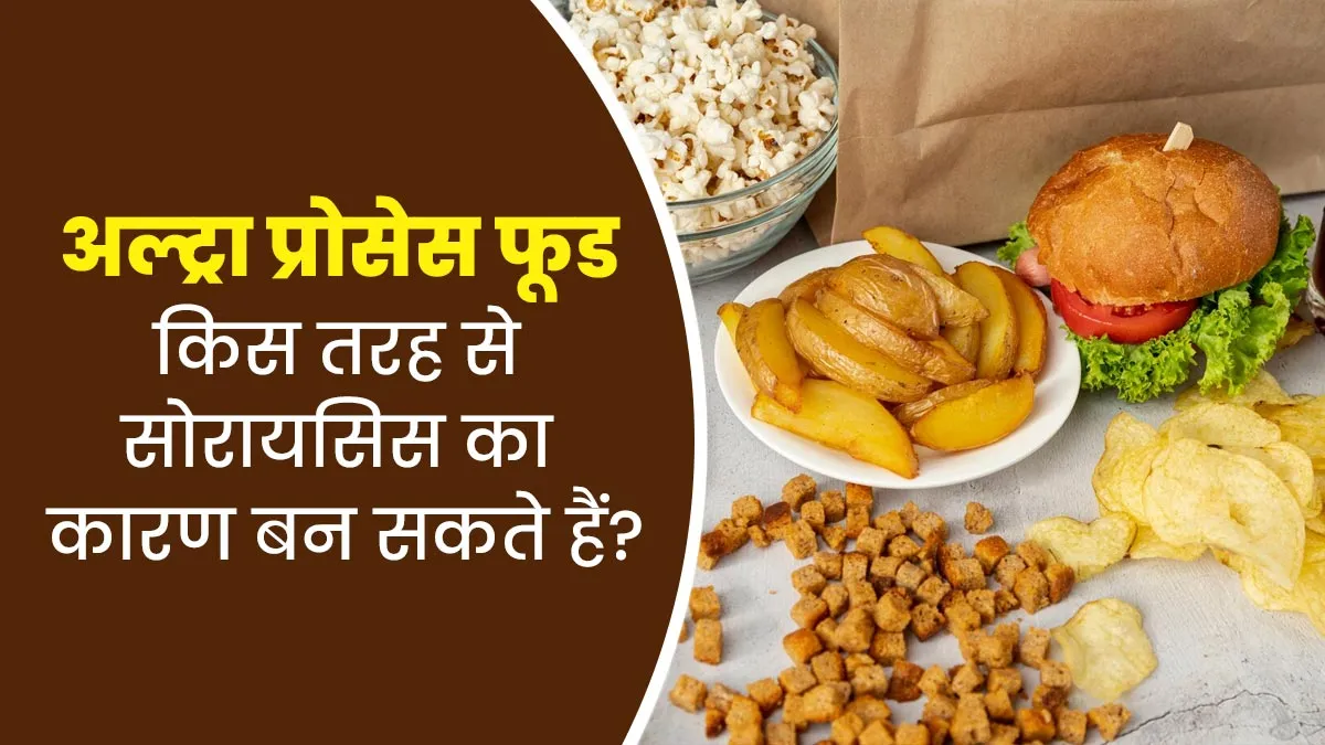 अल्ट्रा-प्रोसेस्ड फूड्स  किस तरह से सोरायसिस का कारण बन सकते हैं? डॉक्टर से जानें